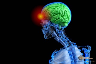 la petite annonce Et si la migraine était génétique ? sur Sibesoin.com /  